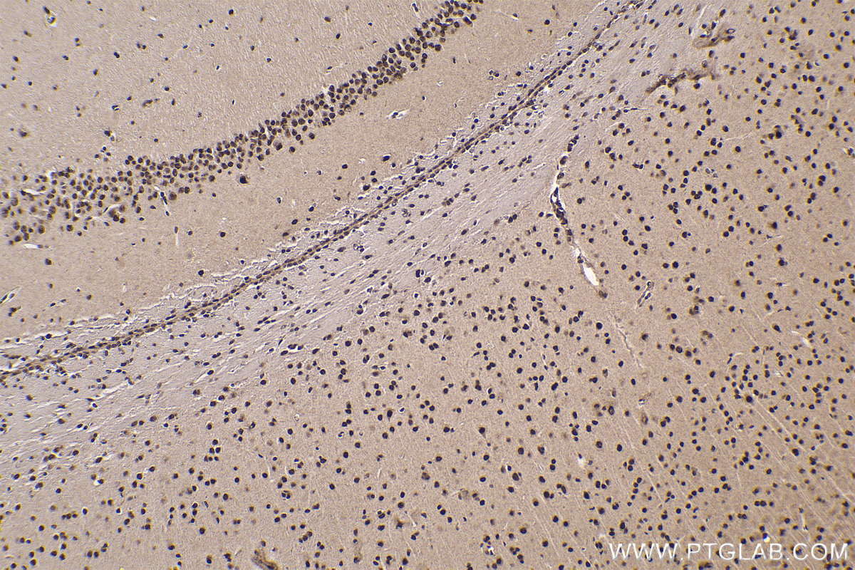 Immunohistochemical analysis of paraffin-embedded mouse brain tissue slide using KHC1756 (VPS72 IHC Kit).