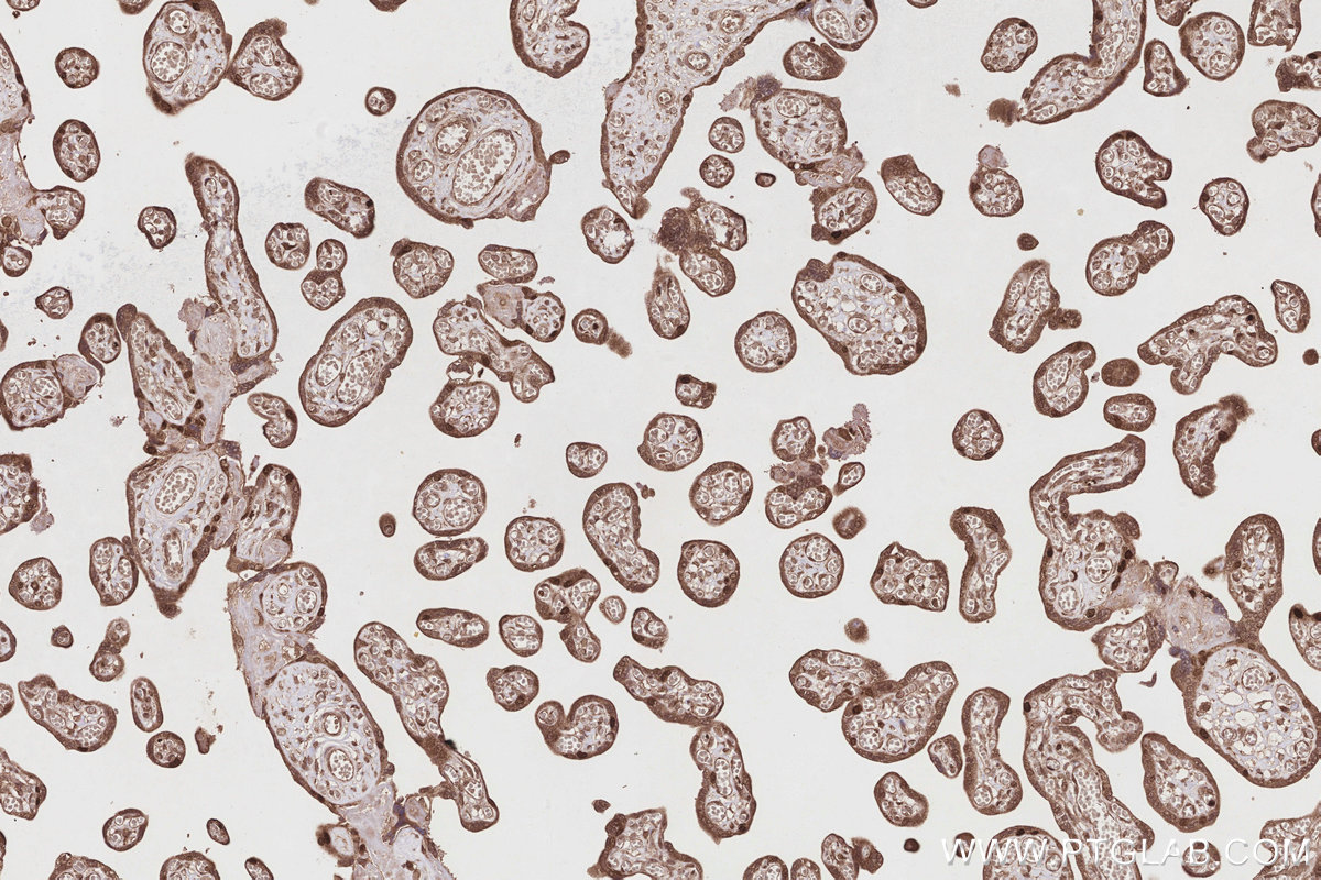 Immunohistochemical analysis of paraffin-embedded human placenta tissue slide using KHC2852 (VRK1 IHC Kit).