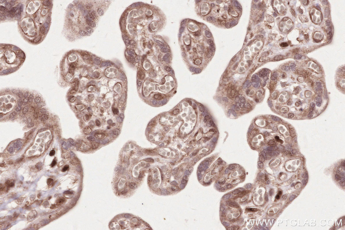 Immunohistochemical analysis of paraffin-embedded human placenta tissue slide using KHC2638 (VRK2 IHC Kit).