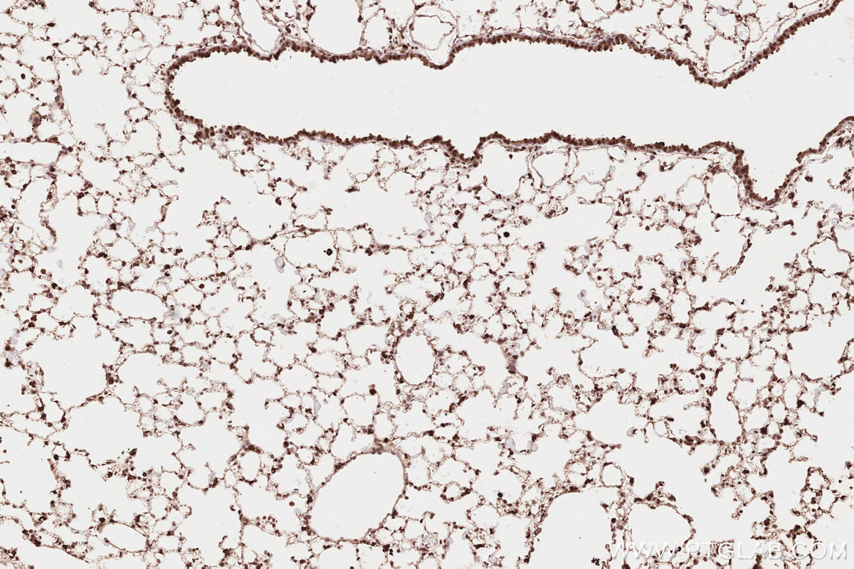Immunohistochemical analysis of paraffin-embedded mouse lung tissue slide using KHC2638 (VRK2 IHC Kit).