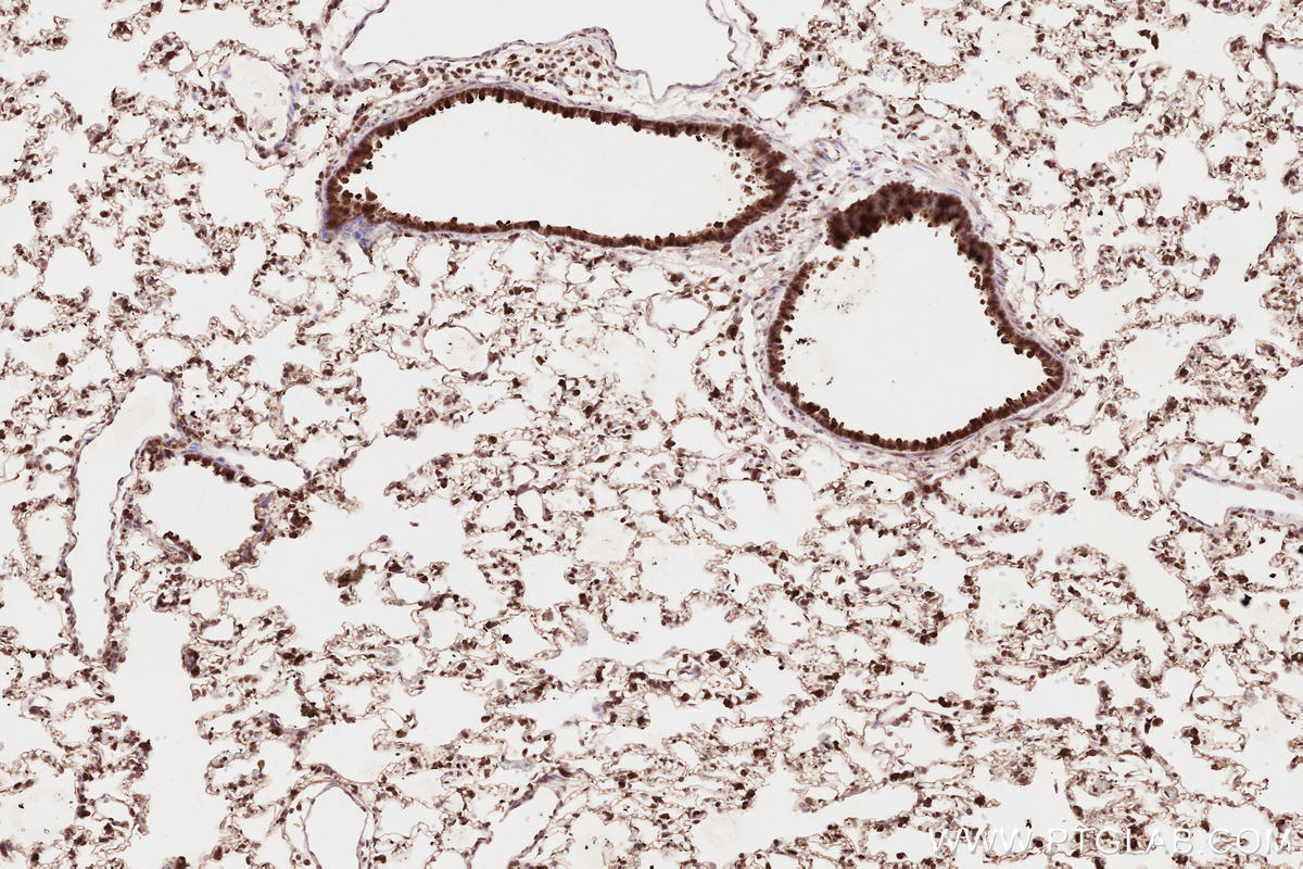 Immunohistochemical analysis of paraffin-embedded rat lung tissue slide using KHC2638 (VRK2 IHC Kit).