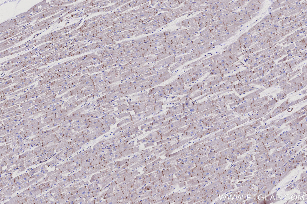 Immunohistochemical analysis of paraffin-embedded human heart tissue slide using KHC3081 (Vinculin IHC Kit). Immunohistochemical analysis of paraffin-embedded human heart tissue slide using KHC3081 (Vinculin IHC Kit).
