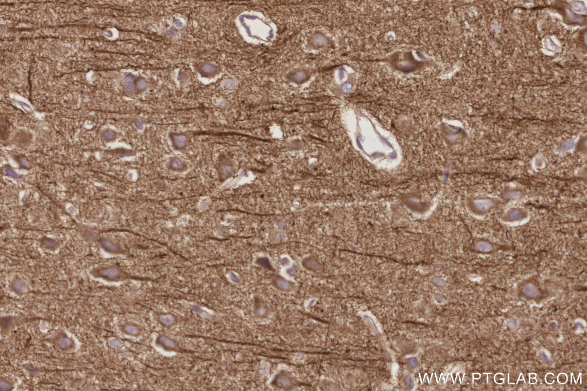 Immunohistochemical analysis of paraffin-embedded rat brain tissue slide using KHC3048 (WASF3 IHC Kit).