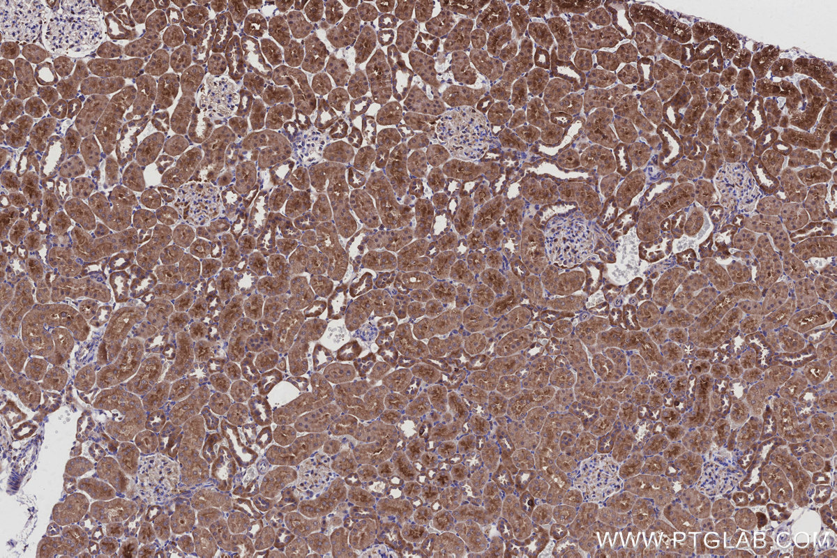 Immunohistochemical analysis of paraffin-embedded rat kidney tissue slide using KHC2921 (WDCP IHC Kit).