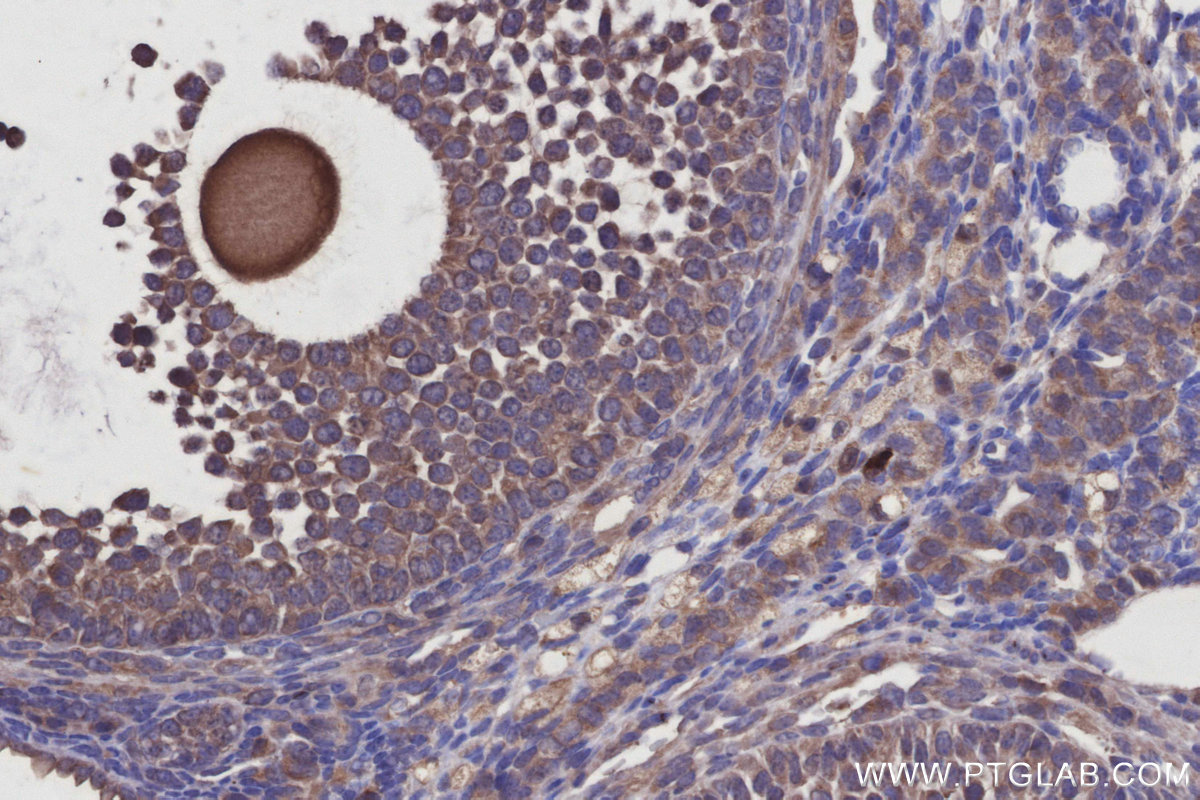 Immunohistochemical analysis of paraffin-embedded mouse ovary tissue slide using KHC2921 (WDCP IHC Kit).
