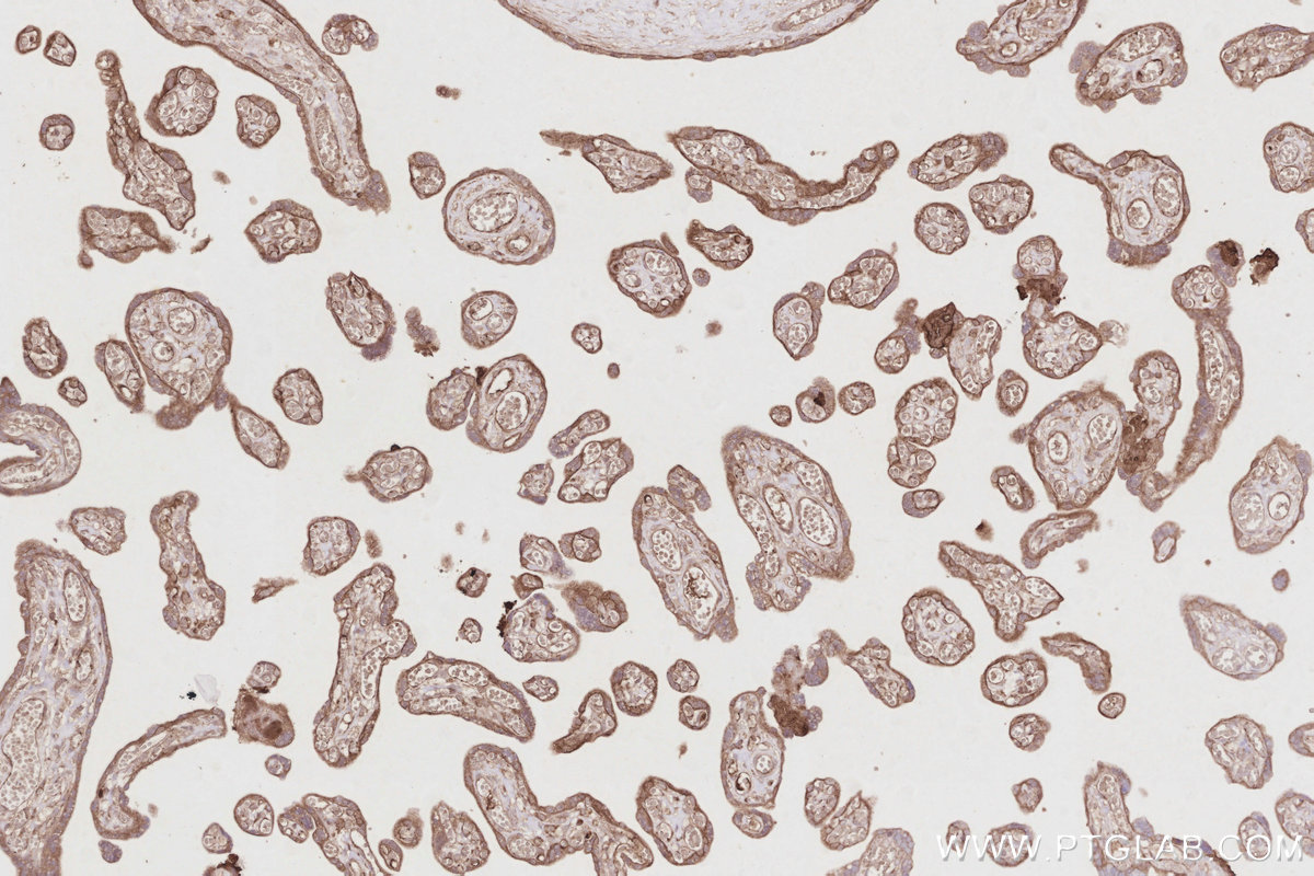 Immunohistochemical analysis of paraffin-embedded human placenta tissue slide using KHC2921 (WDCP IHC Kit).