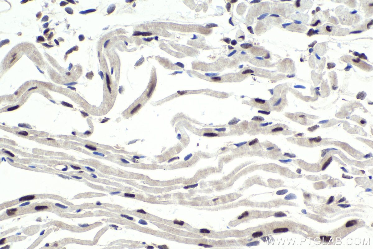 Immunohistochemical analysis of paraffin-embedded mouse heart tissue slide using KHC1916 (WDR33 IHC Kit).