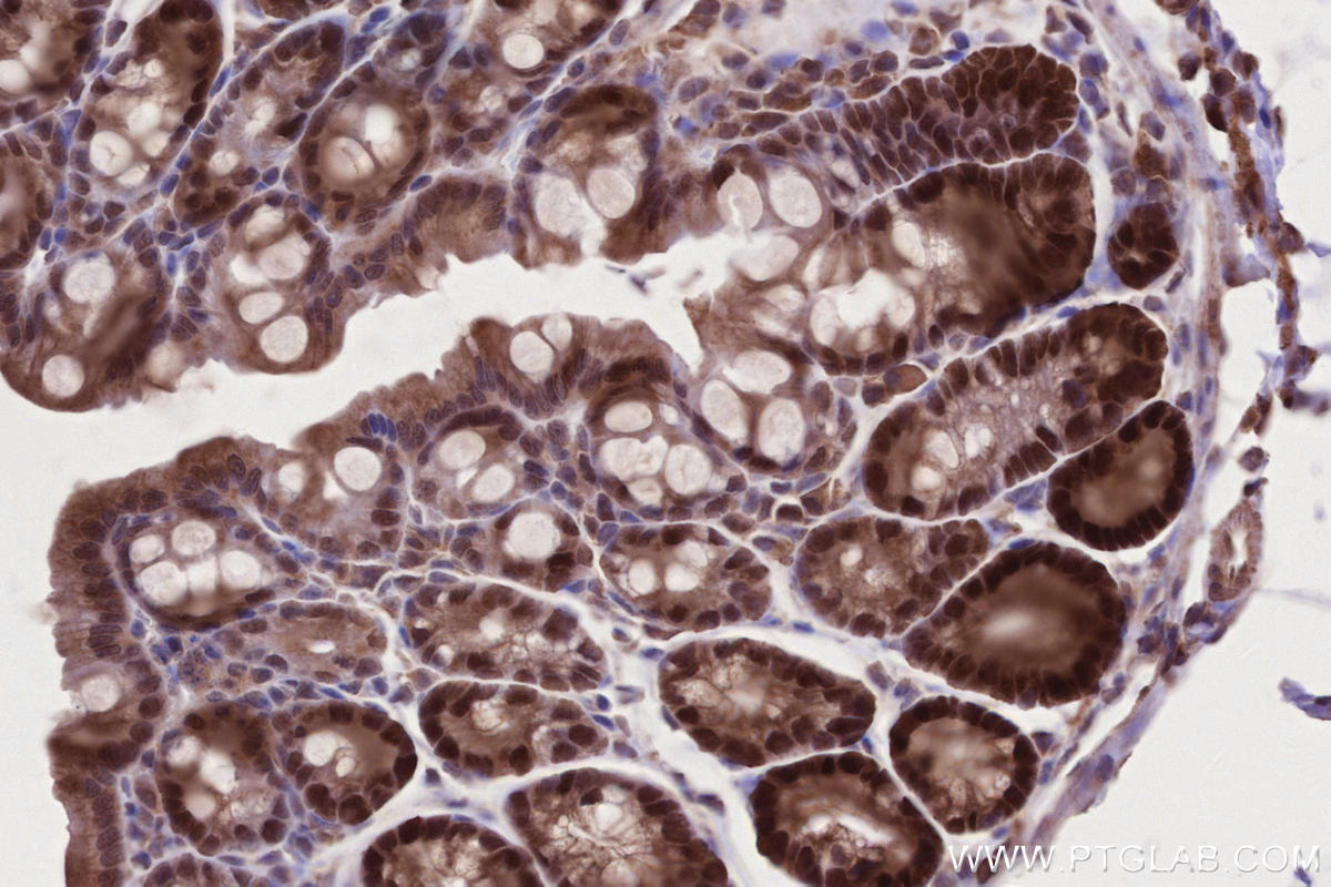 Immunohistochemical analysis of paraffin-embedded mouse colon tissue slide using KHC2705 (WDR48 IHC Kit).