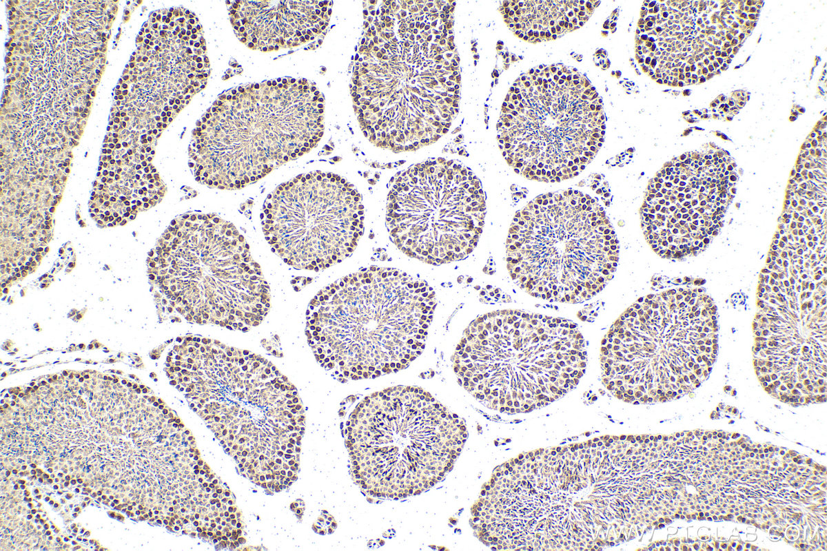 Immunohistochemical analysis of paraffin-embedded mouse testis tissue slide using KHC1643 (WDR5 IHC Kit).