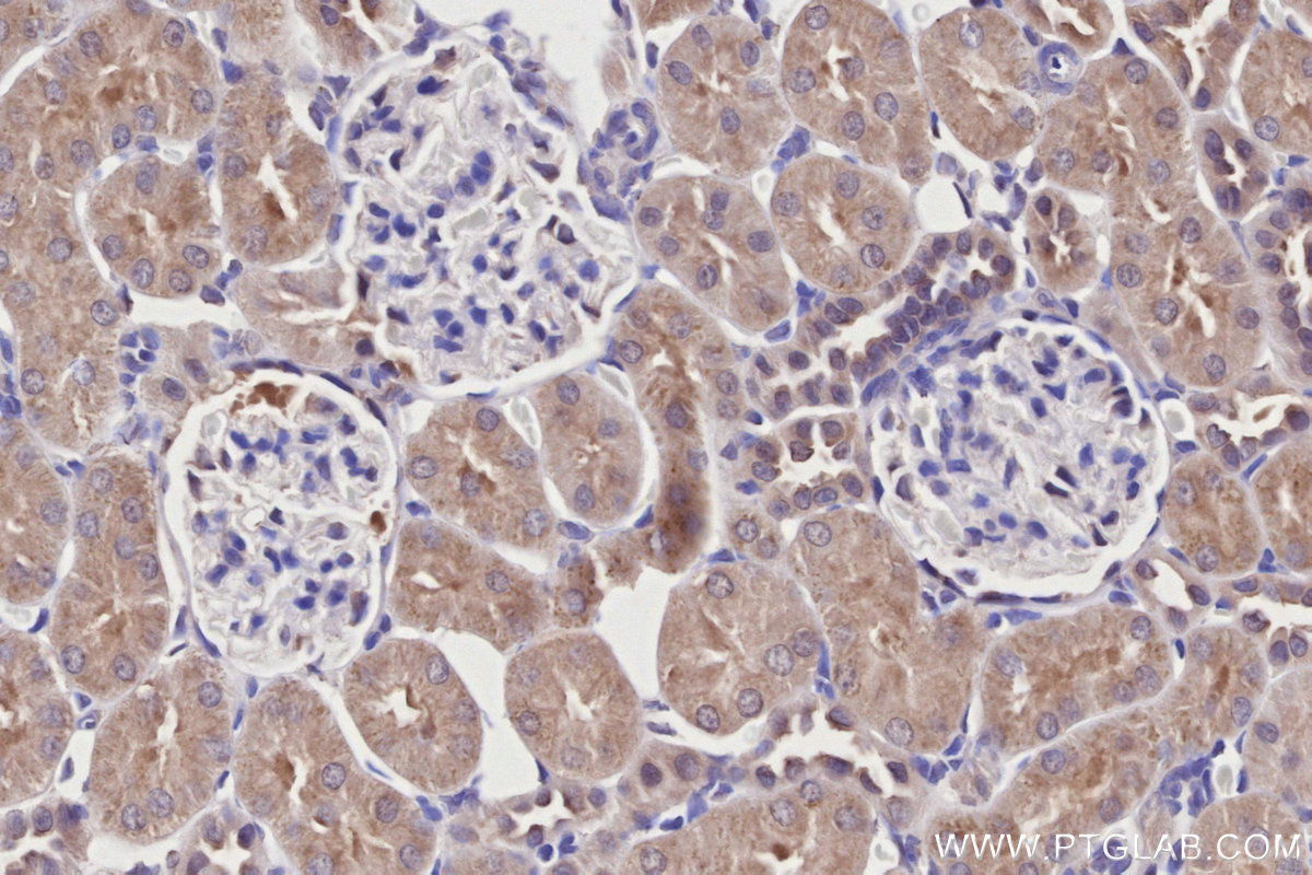 Immunohistochemical analysis of paraffin-embedded rat kidney tissue slide using KHC2728 (WIPF2 IHC Kit).