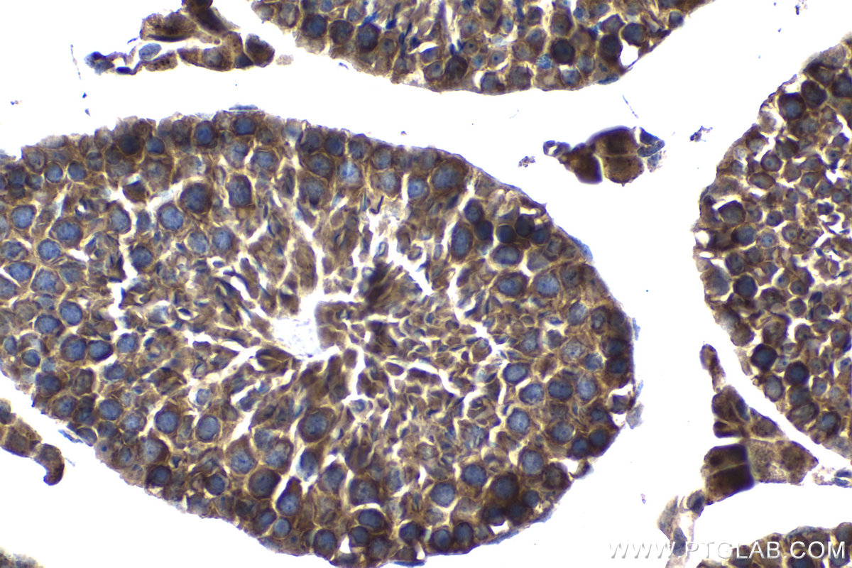 Immunohistochemical analysis of paraffin-embedded mouse testis tissue slide using KHC1294 (WNK1 IHC Kit).