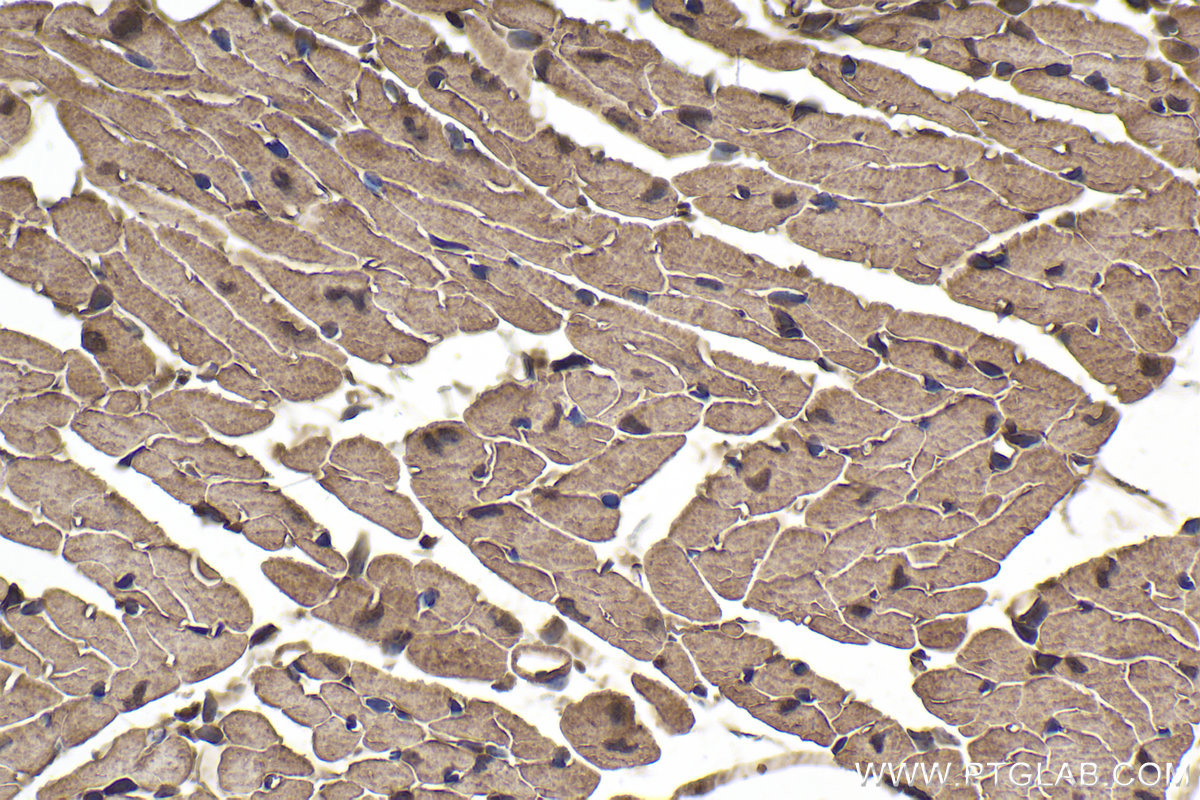 Immunohistochemical analysis of paraffin-embedded mouse heart tissue slide using KHC1920 (WWP1 IHC Kit).