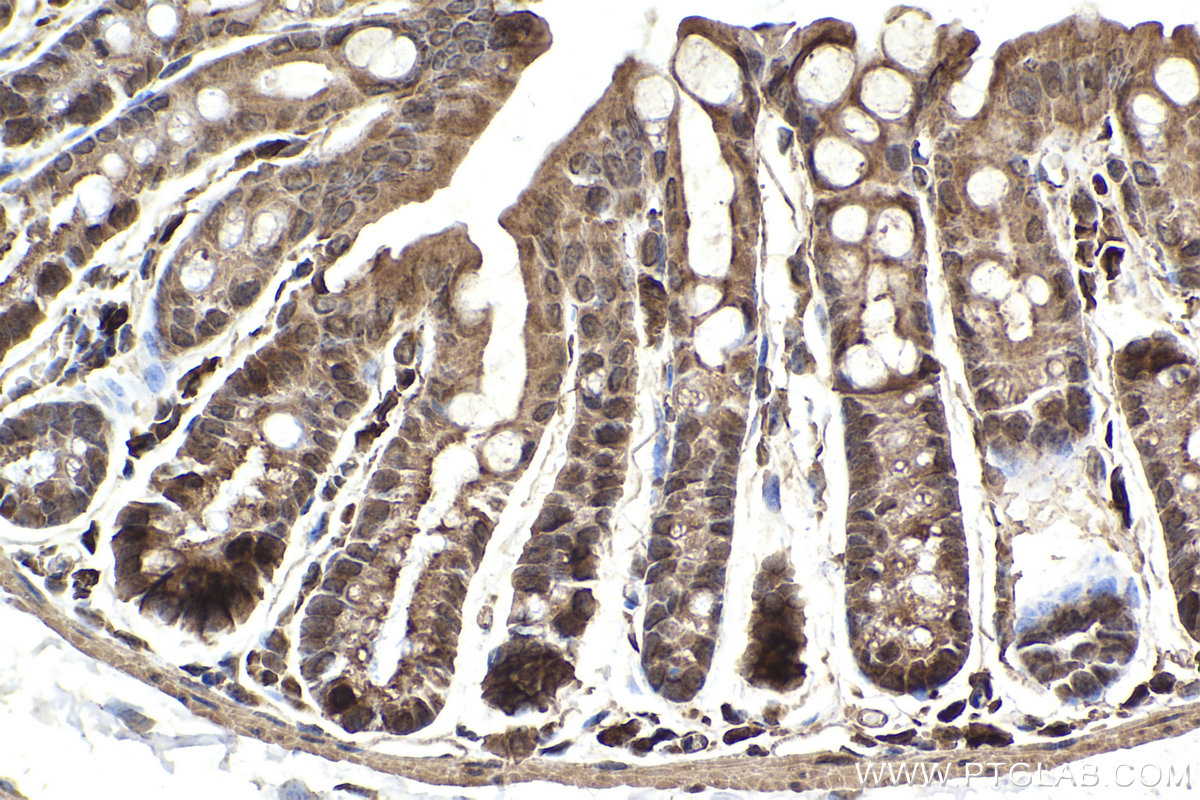Immunohistochemical analysis of paraffin-embedded mouse colon tissue slide using KHC2377 (XIAP IHC Kit).