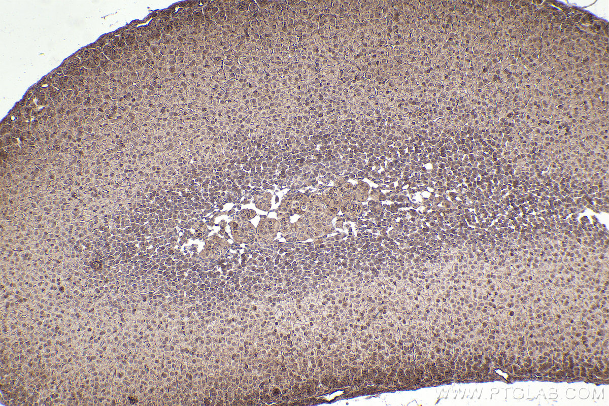 Immunohistochemical analysis of paraffin-embedded mouse adrenal gland tissue slide using KHC2377 (XIAP IHC Kit).