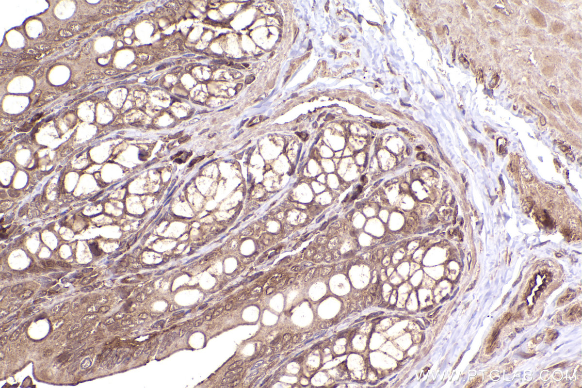 Immunohistochemical analysis of paraffin-embedded rat colon tissue slide using KHC2377 (XIAP IHC Kit).