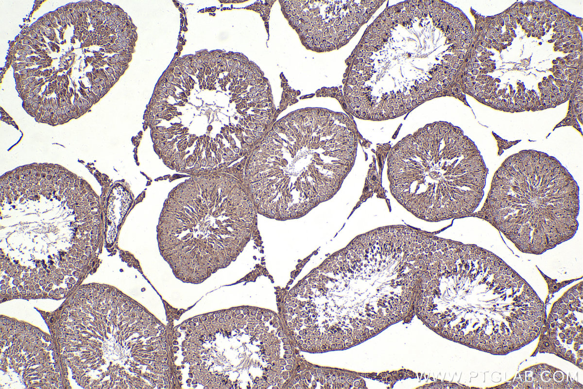 Immunohistochemical analysis of paraffin-embedded rat testis tissue slide using KHC2377 (XIAP IHC Kit).