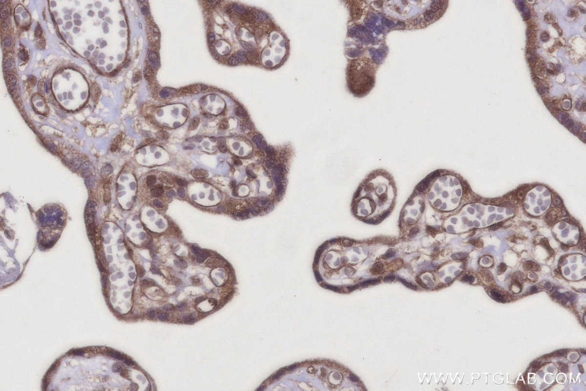 Immunohistochemical analysis of paraffin-embedded human placenta tissue slide using KHC2927 (XPO5 IHC Kit). Immunohistochemical analysis of paraffin-embedded human placenta tissue slide using KHC2927 (XPO5 IHC Kit).