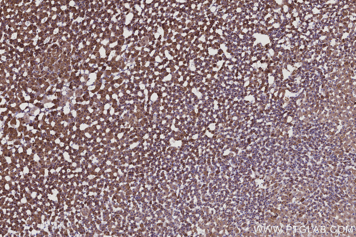 Immunohistochemical analysis of paraffin-embedded rat adrenal gland tissue slide using KHC2927 (XPO5 IHC Kit). Immunohistochemical analysis of paraffin-embedded rat adrenal gland tissue slide using KHC2927 (XPO5 IHC Kit).