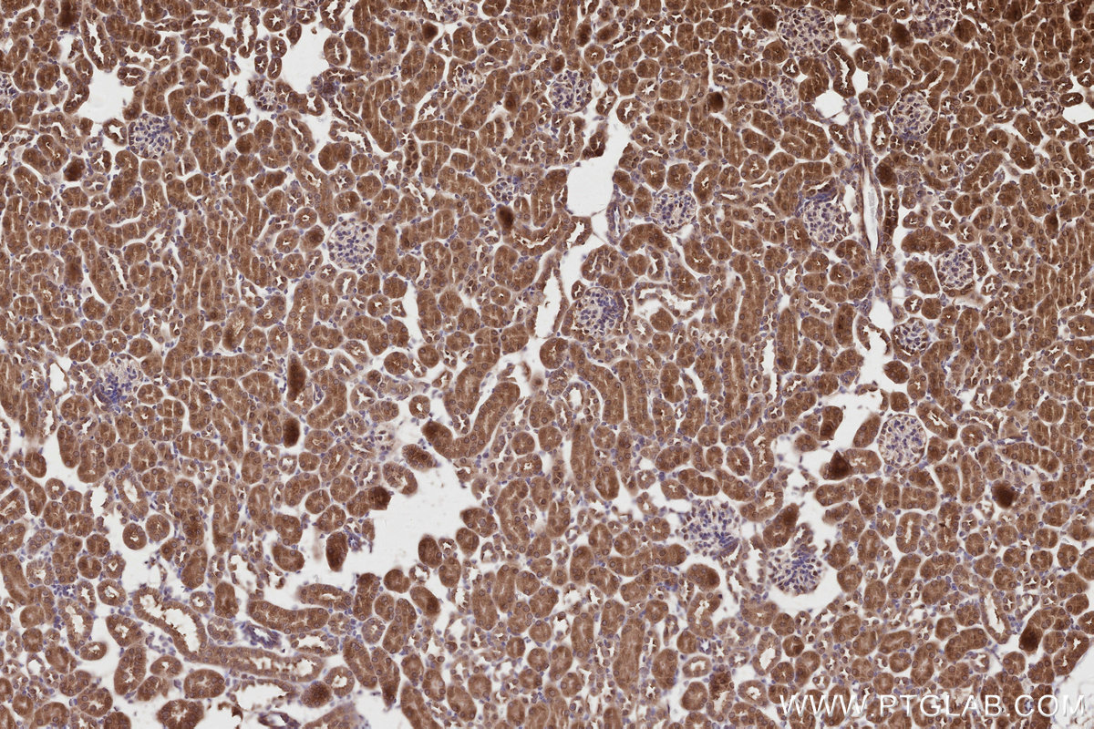 Immunohistochemical analysis of paraffin-embedded mouse kidney tissue slide using KHC2822 (XPO6 IHC Kit).