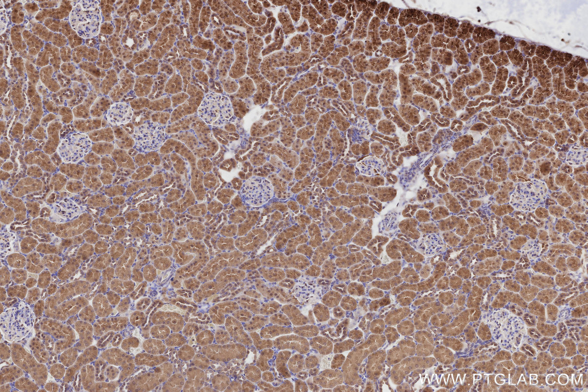 Immunohistochemical analysis of paraffin-embedded rat kidney tissue slide using KHC2822 (XPO6 IHC Kit).