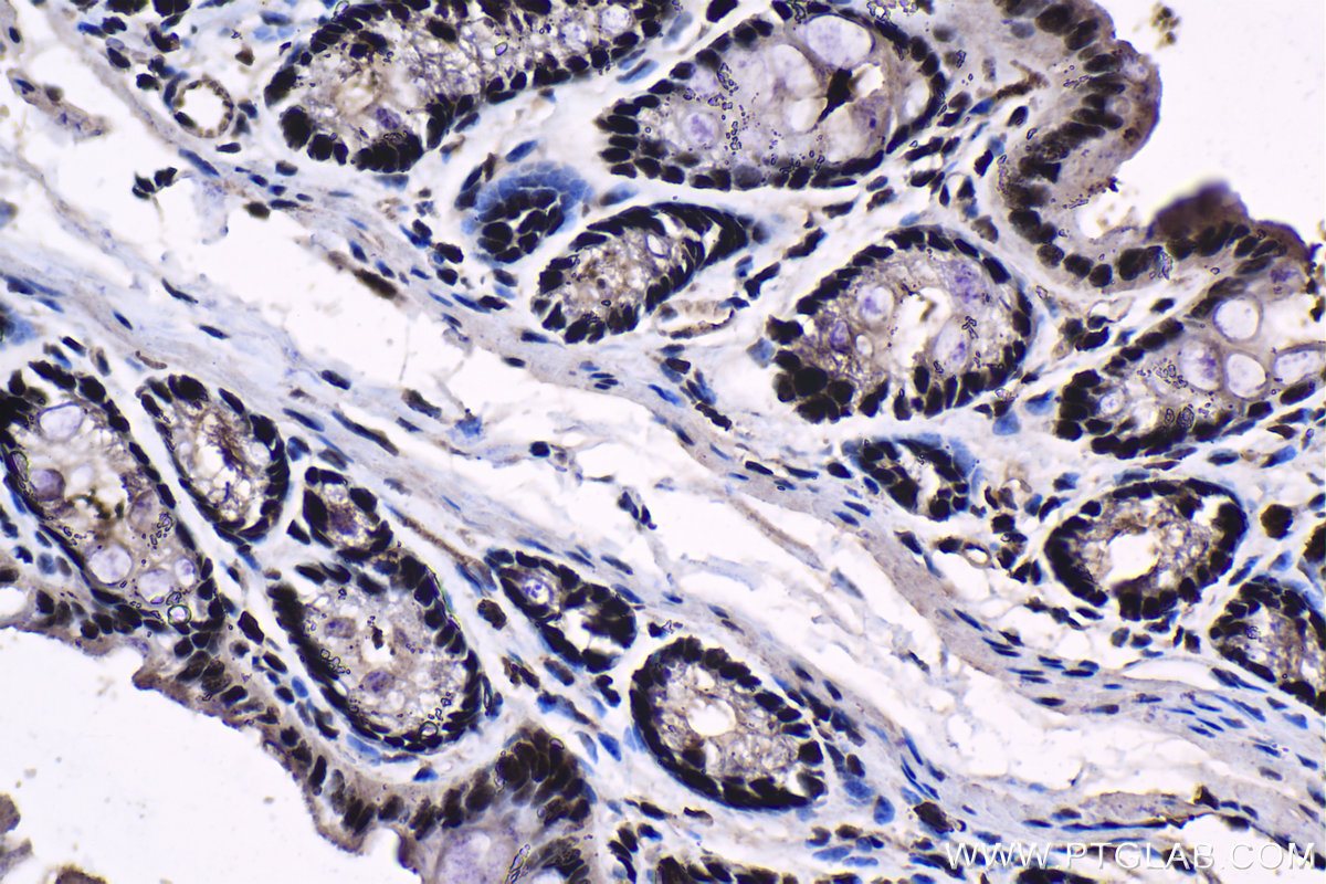 Immunohistochemical analysis of paraffin-embedded mouse colon tissue slide using KHC1381 (XRN2 IHC Kit).