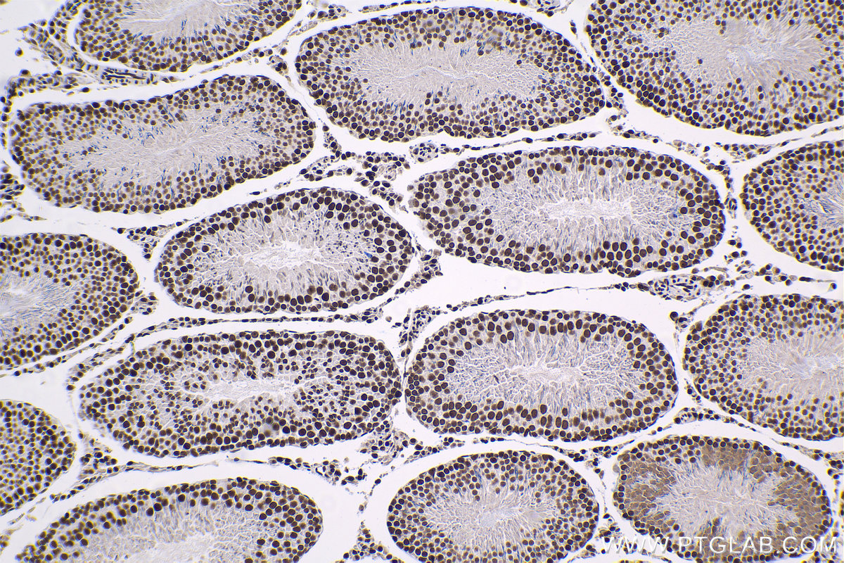 Immunohistochemical analysis of paraffin-embedded rat testis tissue slide using KHC1381 (XRN2 IHC Kit).