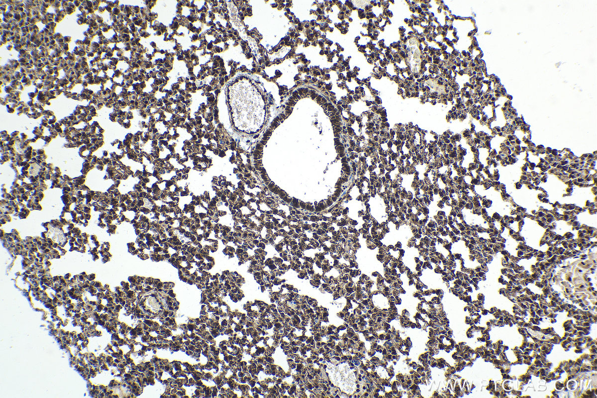 Immunohistochemical analysis of paraffin-embedded mouse lung tissue slide using KHC1608 (YAP1 IHC Kit).