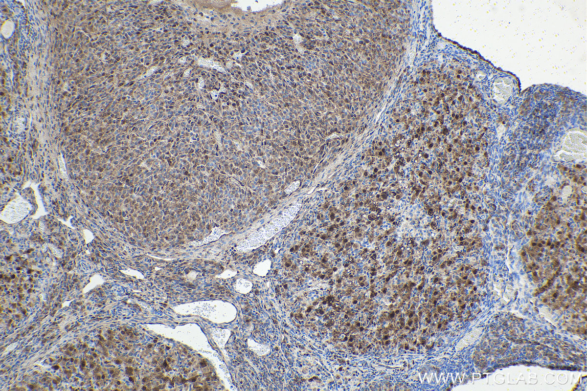 Immunohistochemical analysis of paraffin-embedded rat ovary tissue slide using KHC1608 (YAP1 IHC Kit).