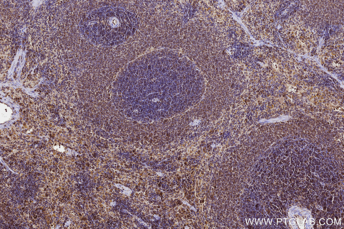 Immunohistochemical analysis of paraffin-embedded rat spleen tissue slide using KHC3228 (YARS IHC Kit).