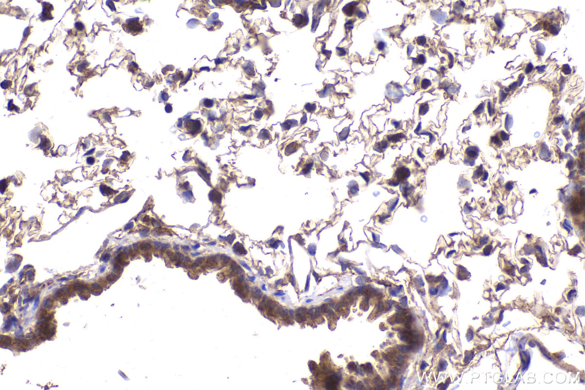 Immunohistochemical analysis of paraffin-embedded rat lung tissue slide using KHC2166 (YES1 IHC Kit).