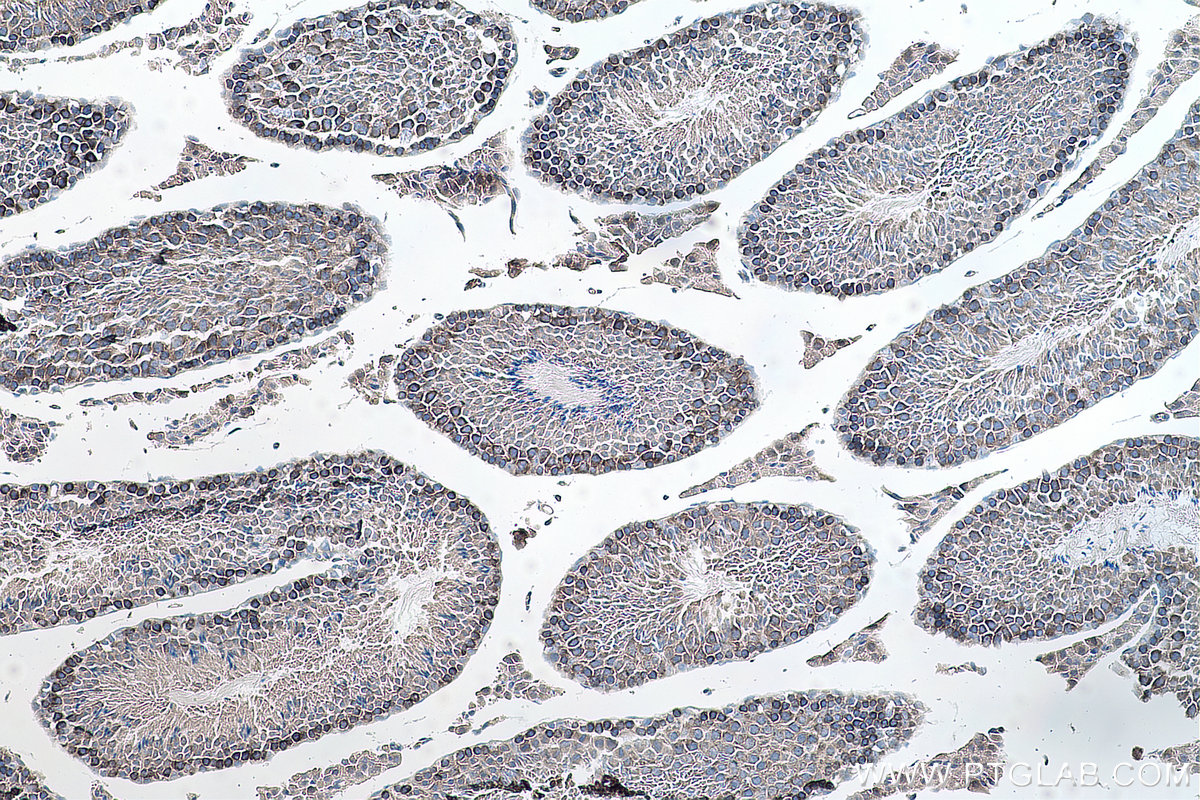 Immunohistochemical analysis of paraffin-embedded mouse testis tissue slide using KHC0156 (YTHDC2 IHC Kit).