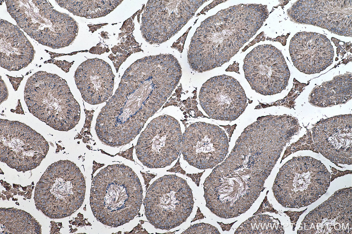 Immunohistochemical analysis of paraffin-embedded mouse testis tissue slide using KHC0157 (YTHDF1 IHC Kit).