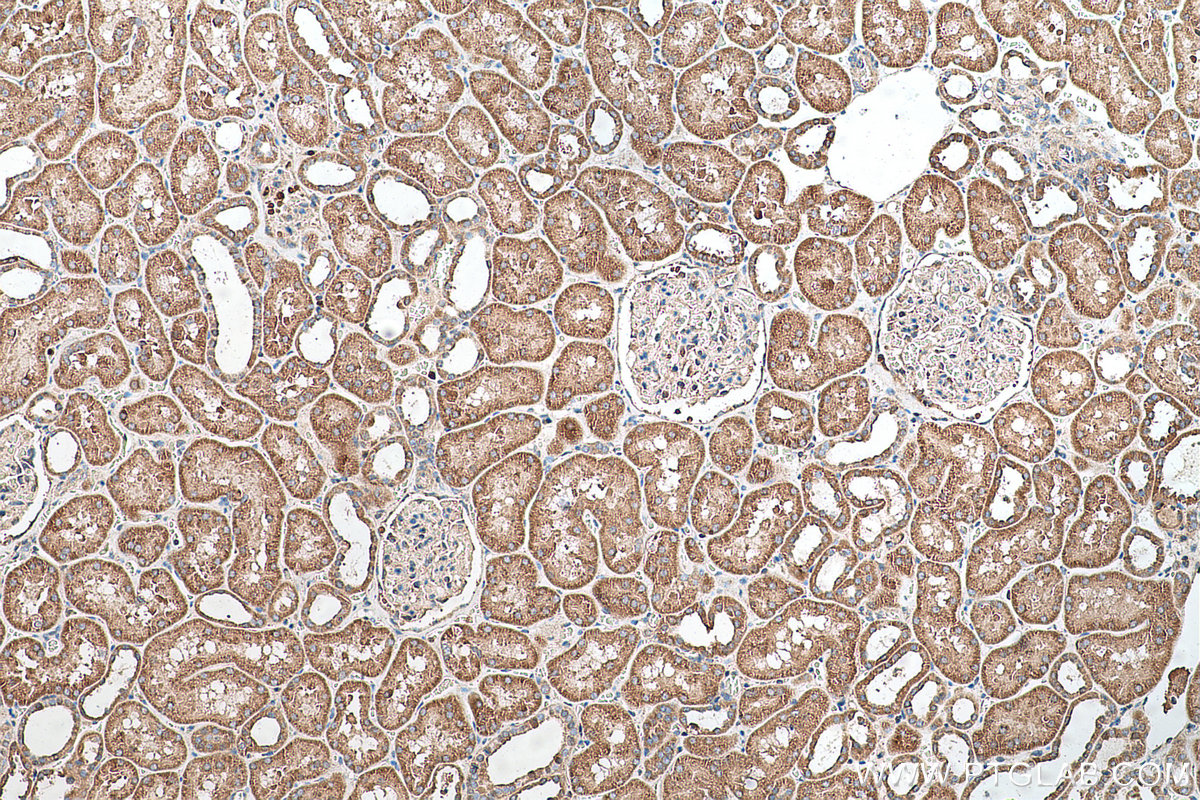 Immunohistochemical analysis of paraffin-embedded human kidney tissue slide using KHC0701 (YWHAB IHC Kit).