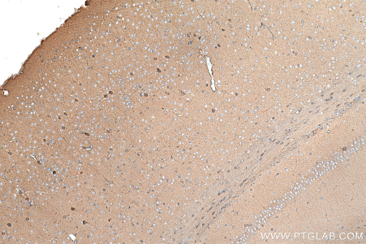 Immunohistochemical analysis of paraffin-embedded mouse brain tissue slide using KHC0701 (YWHAB IHC Kit).