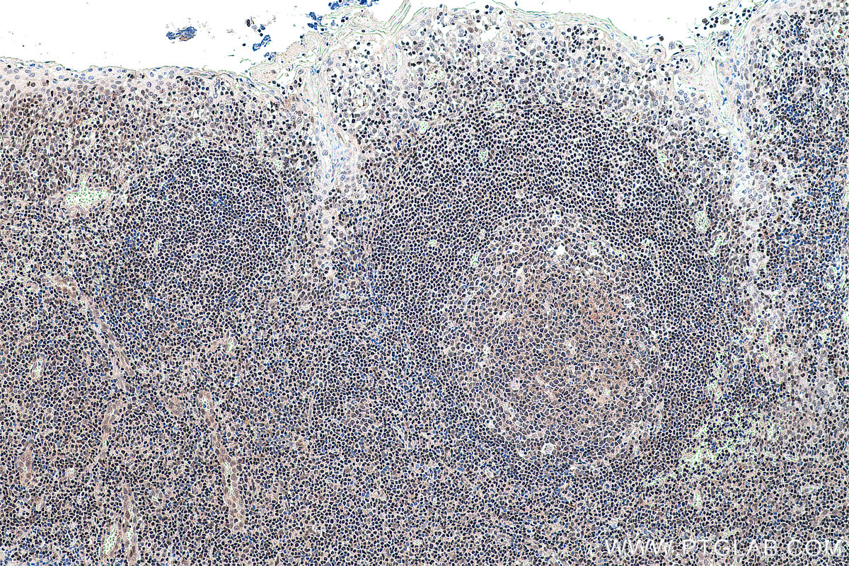 Immunohistochemical analysis of paraffin-embedded human tonsillitis tissue slide using KHC0132 (YY1 IHC Kit).