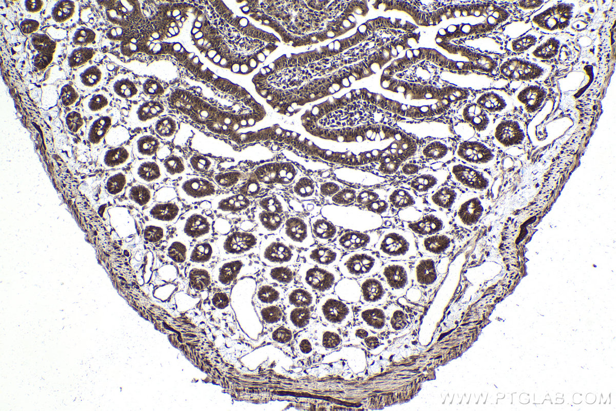 Immunohistochemical analysis of paraffin-embedded rat small intestine tissue slide using KHC1805 (ZBTB33 IHC Kit).