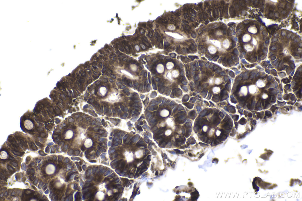 Immunohistochemical analysis of paraffin-embedded mouse small intestine tissue slide using KHC2038 (ZC3H12D IHC Kit).