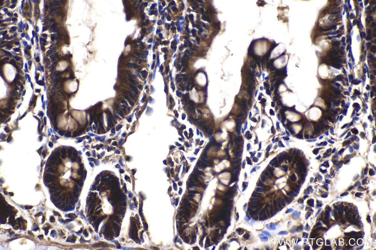 Immunohistochemical analysis of paraffin-embedded rat small intestine tissue slide using KHC2038 (ZC3H12D IHC Kit).