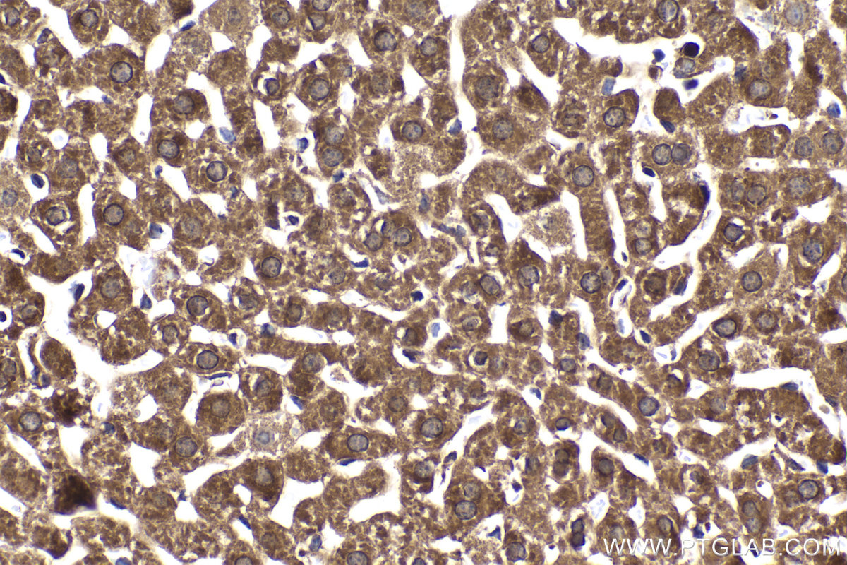 Immunohistochemical analysis of paraffin-embedded mouse liver tissue slide using KHC2038 (ZC3H12D IHC Kit).
