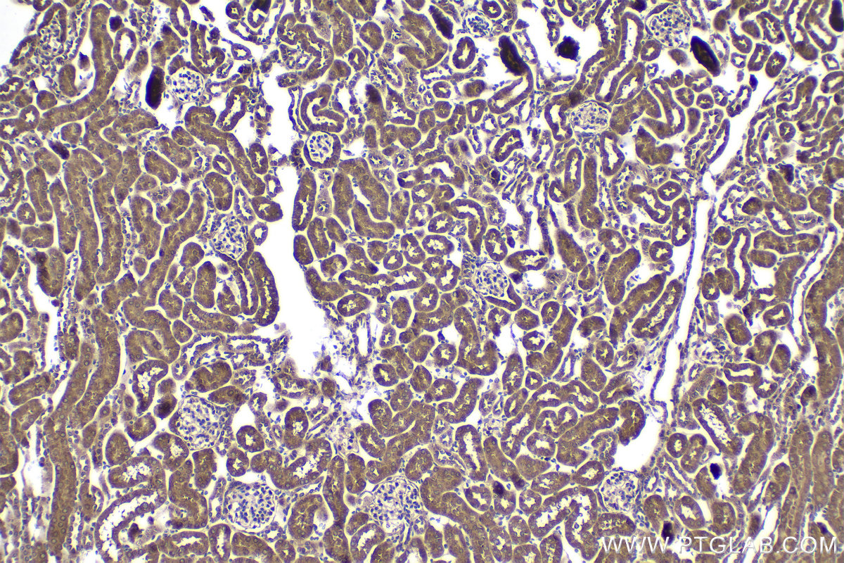 Immunohistochemical analysis of paraffin-embedded mouse kidney tissue slide using KHC2038 (ZC3H12D IHC Kit).
