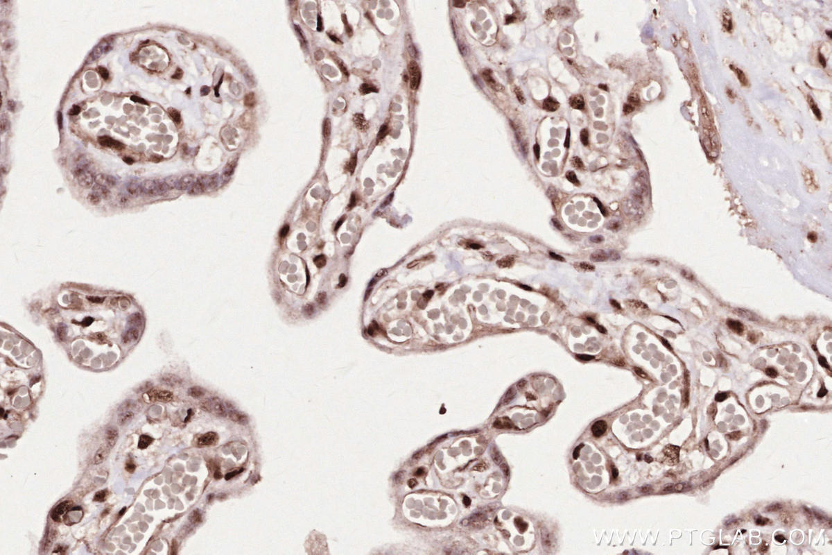 Immunohistochemical analysis of paraffin-embedded human placenta tissue slide using KHC2593 (ZC3H14 IHC Kit).