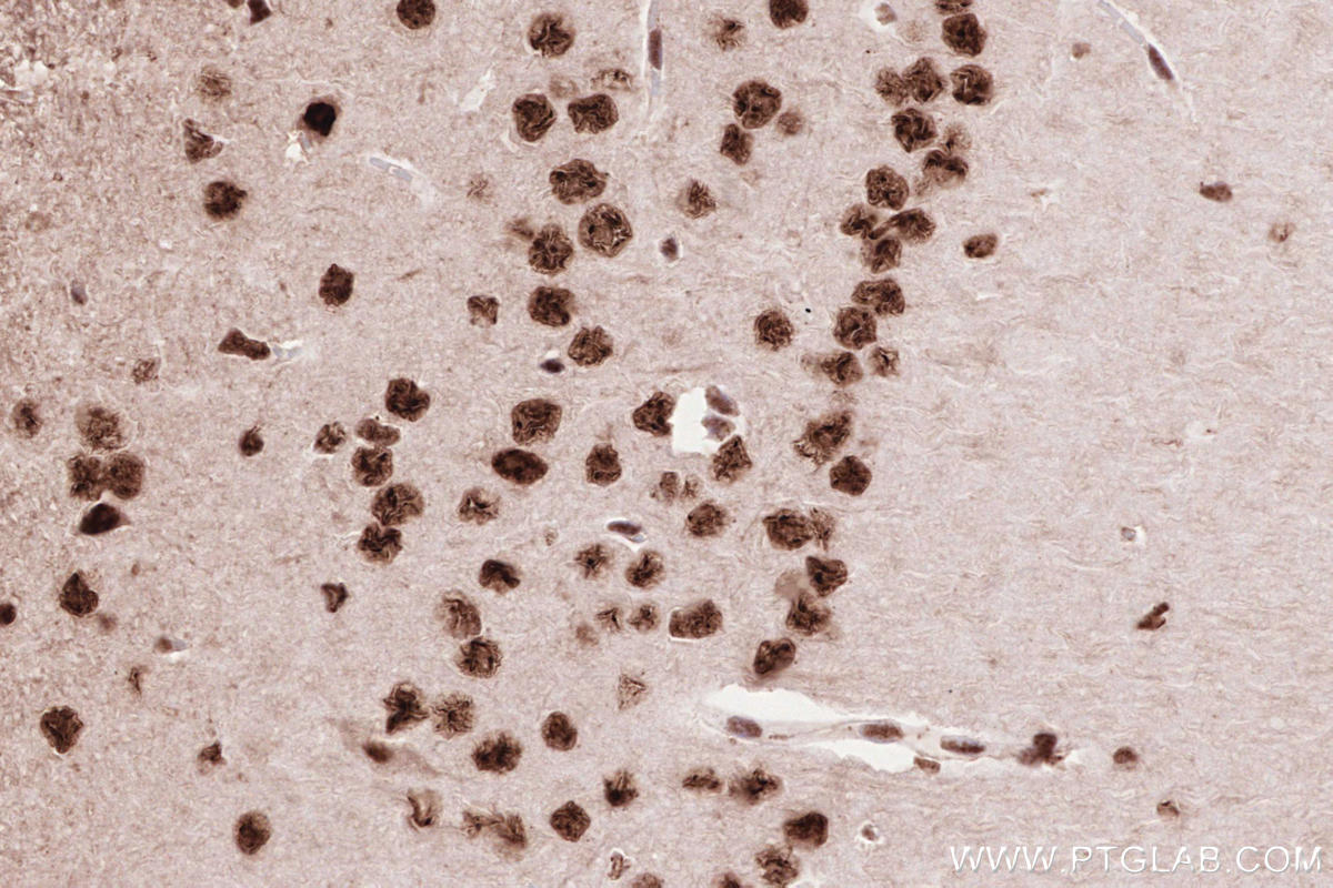 Immunohistochemical analysis of paraffin-embedded mouse brain tissue slide using KHC2593 (ZC3H14 IHC Kit).