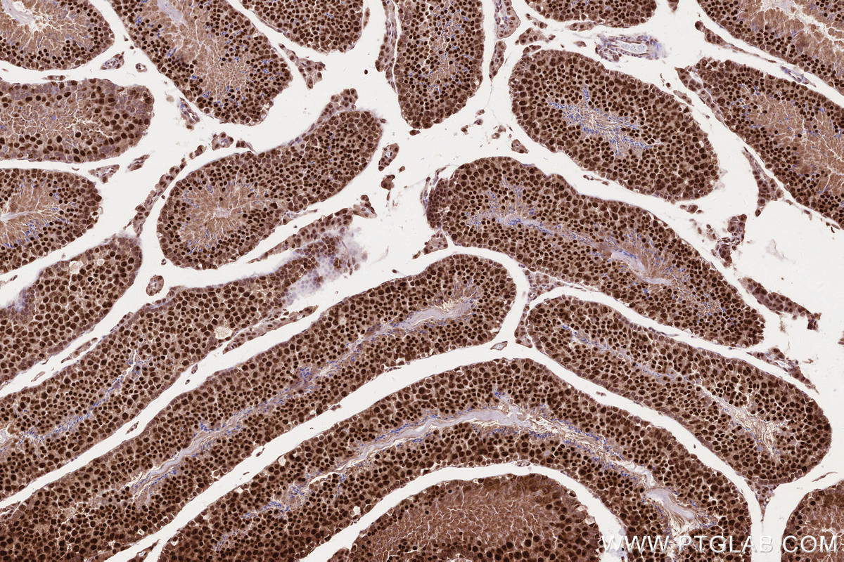 Immunohistochemical analysis of paraffin-embedded mouse testis tissue slide using KHC2593 (ZC3H14 IHC Kit).