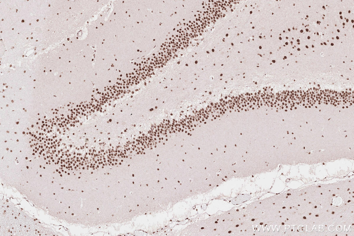 Immunohistochemical analysis of paraffin-embedded rat brain tissue slide using KHC2593 (ZC3H14 IHC Kit).