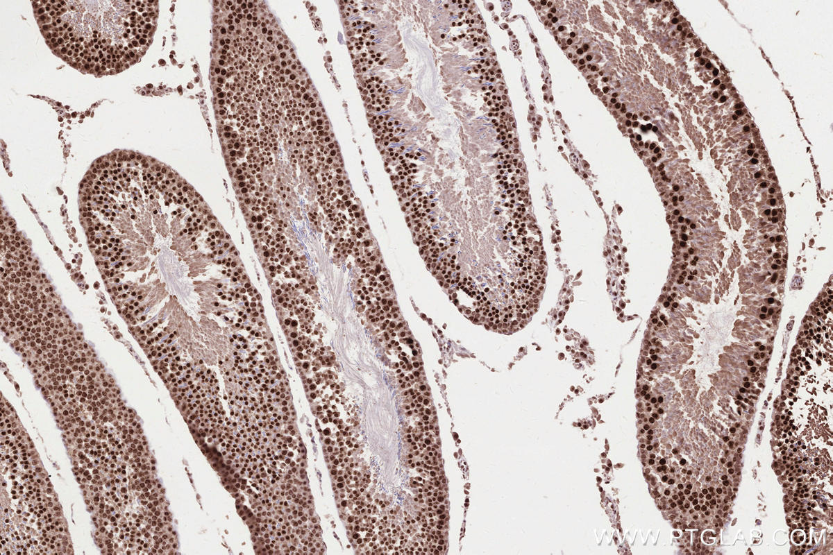 Immunohistochemical analysis of paraffin-embedded rat testis tissue slide using KHC2593 (ZC3H14 IHC Kit).