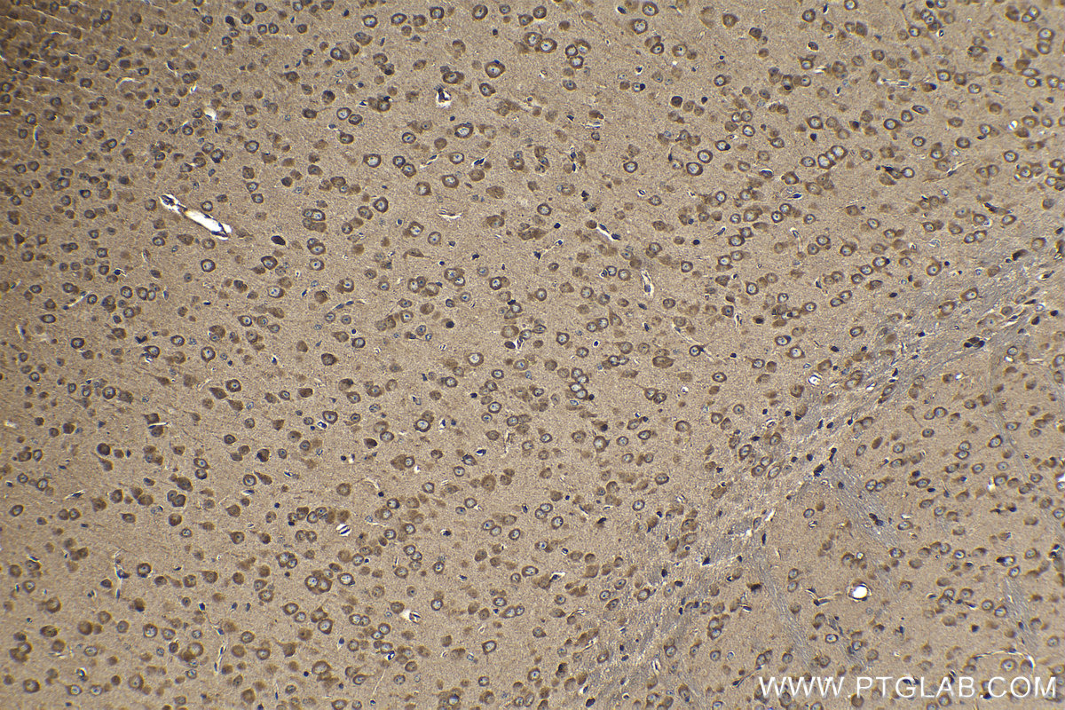 Immunohistochemical analysis of paraffin-embedded mouse brain tissue slide using KHC1232 (ZC3H15 IHC Kit).