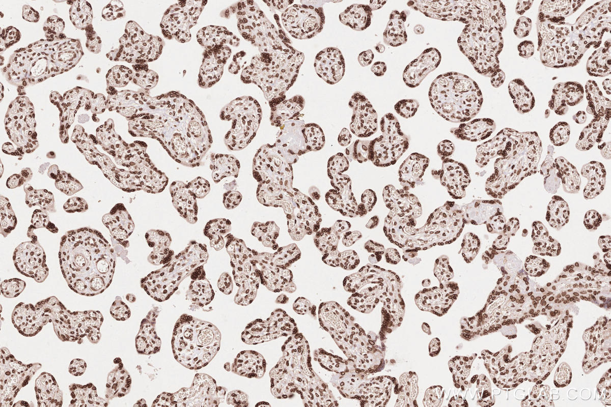 Immunohistochemical analysis of paraffin-embedded human placenta tissue slide using KHC2637 (ZC3HC1 IHC Kit).