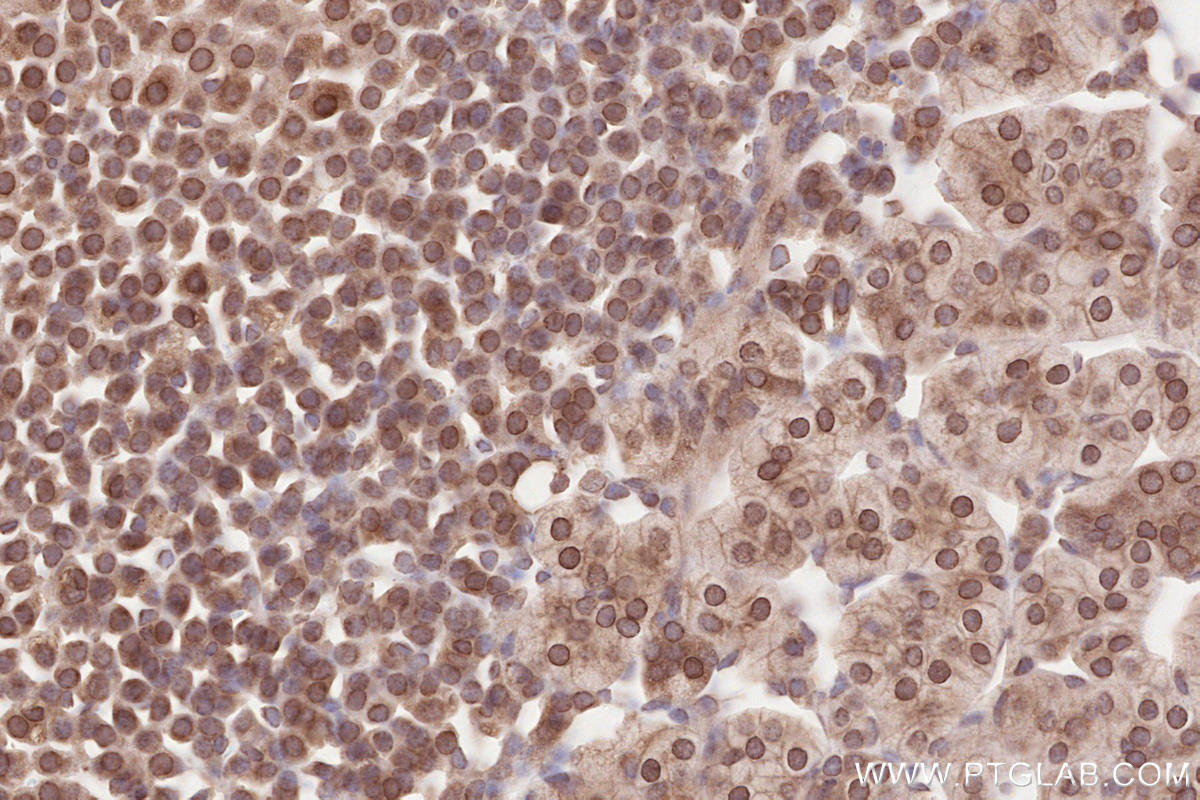 Immunohistochemical analysis of paraffin-embedded mouse adrenal gland tissue slide using KHC2637 (ZC3HC1 IHC Kit).