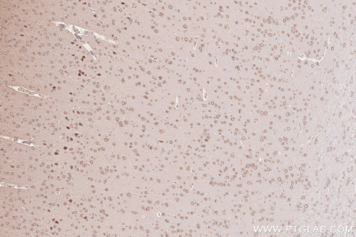 Immunohistochemical analysis of paraffin-embedded rat brain tissue slide using KHC2637 (ZC3HC1 IHC Kit).
