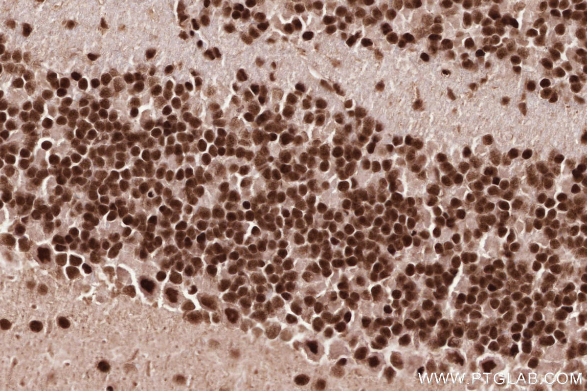 Immunohistochemical analysis of paraffin-embedded mouse cerebellum tissue slide using KHC2584 (ZCCHC8 IHC Kit).